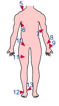 Réagir face à une HÉMORRAGIE : Le pansement compressif ı Formation